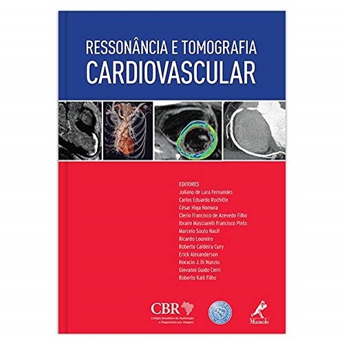 Ressonância e Tomografia Cardiovascular (Em Portuguese do Brasil) Ressonância e Tomografia Cardiovascular (Em Portuguese do Brasil)
