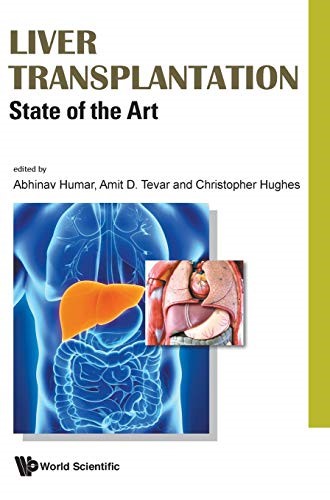 Liver Transplantation: State Of The Art (Gastroenterology)